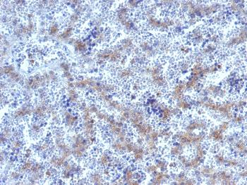 Anti-Glypican-3 (GPC3) (Hepatocellular Carcinoma Marker) Polyclonal Antibody