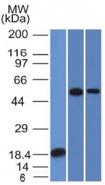 Anti-TOX3 / TNRC9 Monoclonal Antibody(Clone: TOX3/1124)