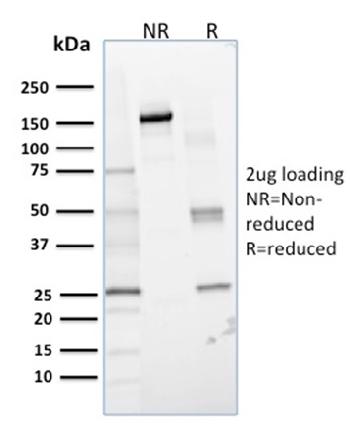 Anti-Lactoylglutathione Lyase Monoclonal Antibody(Clone: CPTC-GLO1-1)