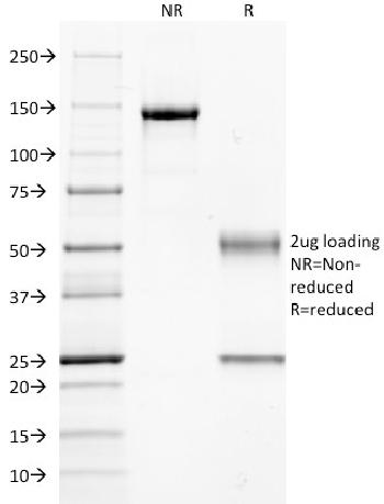 Anti-Guanine nucleotide-binding protein alpha-q / GNAQ / G-ALPHA-q Monoclonal Antibody(Clone: GNAQ/2434)