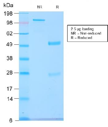 Anti-GnRH-Receptor / LH-RH Receptor Monoclonal Antibody(Clone: GNRHR/2982R)