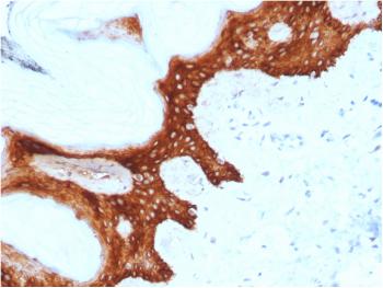 Anti-14-3-3 Sigma / Stratifin Monoclonal Antibody(Clone: CPTC-SFN-2)