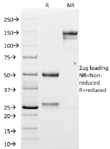 Anti-GP2 (Glycoprotein 2) / ZAP75 Monoclonal Antibody(Clone: GP2/1551)(Discontinued)