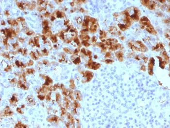 Anti-GP2 (Glycoprotein 2) / ZAP75 Monoclonal Antibody(Clone: GP2/1803)