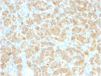 Anti-GP2 (Glycoprotein 2) / ZAP75 Monoclonal Antibody(Clone: GP2/2569R)