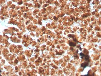 Anti-GP2 (Glycoprotein 2) / ZAP75 Monoclonal Antibody(Clone: GP2/3134R)