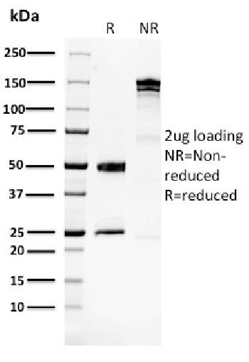 Anti-Glucose 6-Phosphate Isomerase Monoclonal Antibody(Clone: CPTC-GPI-1)