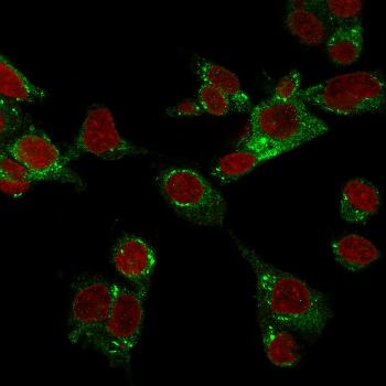 Anti-GPX4 / MCSP Monoclonal Antibody(Clone: LHM 2)