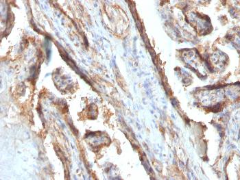 Anti-Galectin-13 (GAL13) / Placental Protein 13 (PP13) Monoclonal Antibody(Clone: PP13/1161)