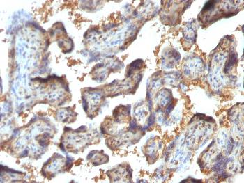 Anti-Galectin-13 (GAL13) / Placental Protein 13 (PP13) Monoclonal Antibody(Clone: PP13/1164)