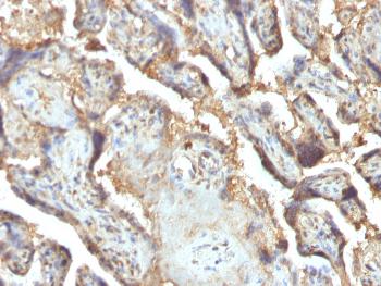 Anti-Galectin-13 (GAL13) / Placental Protein 13 (PP13) Monoclonal Antibody(Clone: PP13/1165)