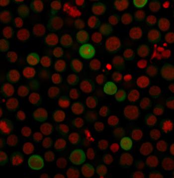 Anti-PD-L1 / PDCD1LG1 / CD274 / B7-H1 (Cancer Immunotherapy Target) Monoclonal Antibody(Clone: PDL1/2743)