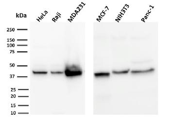 Anti-PD-L1 / PDCD1LG1 / CD274 / B7-H1 (Cancer Immunotherapy Target) Monoclonal Antibody(Clone: PDL1/2744)