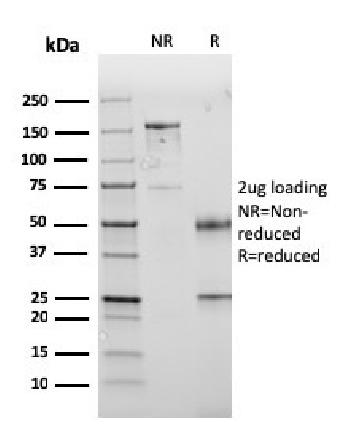 Anti-PD-L1 / PDCD1LG1 / CD274 / B7-H1 (Cancer Immunotherapy Target) Monoclonal Antibody(Clone: PDL1/2745)