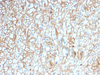 Anti-PD-L1 / PDCD1LG1 / CD274 / B7-H1 (Cancer Immunotherapy Target) Monoclonal Antibody(Clone: PDL1/2746)