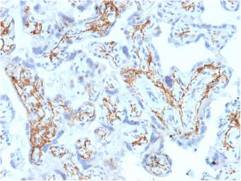 Anti-Glutathione S-Transferase Mu1 (GSTM1) Monoclonal Antibody(Clone: CPTC-GSTMu1-3)