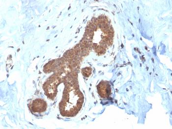 Anti-Glutathione S-Transferase Mu2 (GSTM2) Monoclonal Antibody(Clone: CPTC-GSTMu2-2)