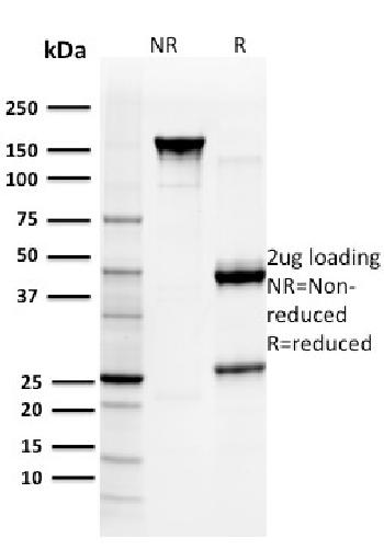 Anti-Glutathione S-Transferase Mu3 (GSTM3) Monoclonal Antibody(Clone: CPTC-GSTMu3-1)