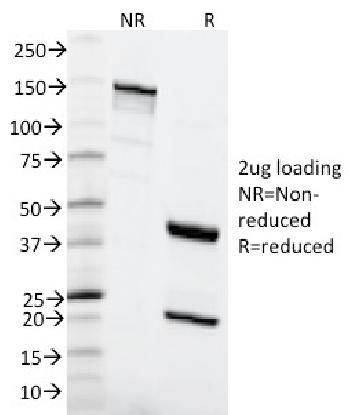 Anti-MSH6 (DNA Mismatch Repair Protein) Monoclonal Antibody(Clone: MSH6/2111)