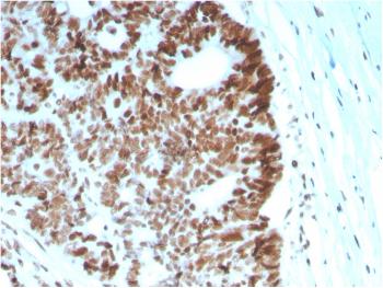 Anti-MSH6 (DNA Mismatch Repair Protein) Monoclonal Antibody(Clone: MSH6/2927)