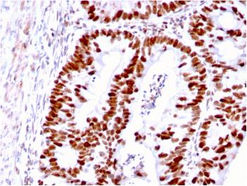 Anti-MSH6 (DNA Mismatch Repair Protein) Monoclonal Antibody(Clone: MSH6/3085)