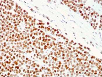 Anti-MSH6 (DNA Mismatch Repair Protein) Monoclonal Antibody(Clone: MSH6/3086)