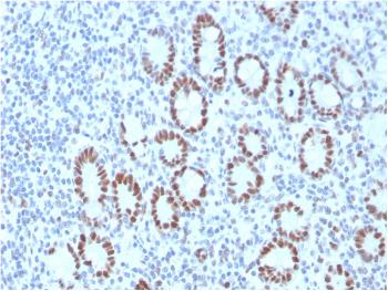 Anti-MSH6 (DNA Mismatch Repair Protein) Monoclonal Antibody(Clone: MSH6/3089)