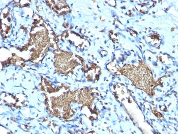 Anti-Glycophorin A / CD235a (Erythrocyte Marker Monoclonal Antibody(Clone: GYPA/1725R)