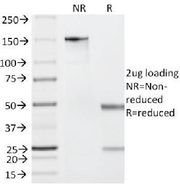 Anti-Granzyme B (NK/T-Cell Lymphoma Marker) Monoclonal Antibody(Clone: GZMB/2403)