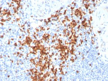 Anti-Granzyme B (NK/T-Cell Lymphoma Marker) Monoclonal Antibody(Clone: GZMB/3014)