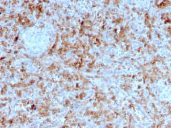 Anti-Granzyme B (NK/T-Cell Lymphoma Marker) Monoclonal Antibody(Clone: GZMB/3055)