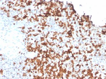 Anti-Granzyme B (NK/T-Cell Lymphoma Marker) Monoclonal Antibody(Clone: GZMB/3056)