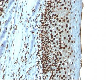 Anti-Histone H1 (Pan Nuclear Marker) Monoclonal Antibody(Clone: r1415-1)