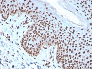 Anti-Histone H1 (Pan Nuclear Marker) Monoclonal Antibody(Clone: rAE-4)