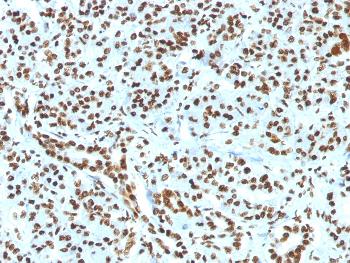 Anti-Histone H1 (Pan Nuclear Marker) Monoclonal Antibody(Clone: HH1/1784R)