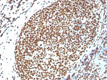 Anti-Histone H1 (Pan Nuclear Marker) Polyclonal Antibody