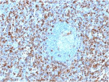 Anti-Annexin A1 / (Hairy Cell Leukemia Marker) Monoclonal Antibody(Clone: ANXA1/1671)