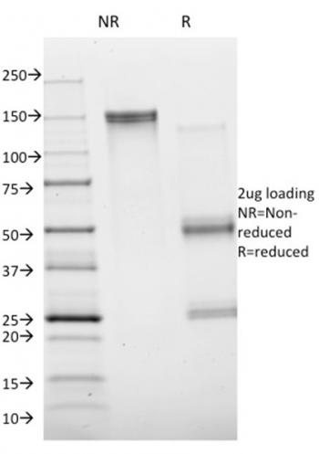 Anti-Annexin A1 / (Hairy Cell Leukemia Marker) Monoclonal Antibody(Clone: ANXA1/1672)