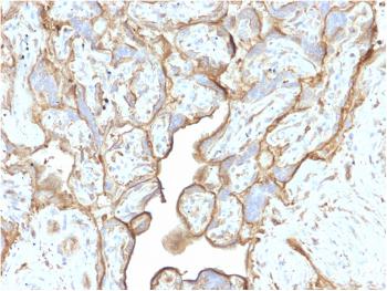 Anti-Annexin A1 / (Hairy Cell Leukemia Marker) Monoclonal Antibody(Clone: CPTC-ANXA1-1)