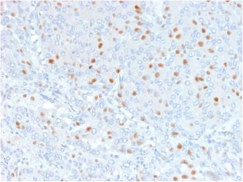 Anti-Annexin A1 / (Hairy Cell Leukemia Marker) Monoclonal Antibody(Clone: 6E4/3)