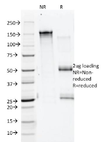 Anti-Annexin A1 / (Hairy Cell Leukemia Marker) Monoclonal Antibody(Clone: 5E4/1)