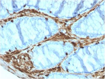 Anti-Annexin A1 / (Hairy Cell Leukemia Marker) Monoclonal Antibody(Clone: ANXA1/3566)