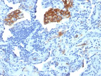 Anti-CD209 / DC-SIGN (Pathogen Receptor on Dendritic Cells) Monoclonal Antibody(Clone: C209/1781)