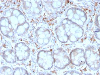 Anti-CD209 / DC-SIGN (Pathogen Receptor on Dendritic Cells) Monoclonal Antibody(Clone: rC209/1781)