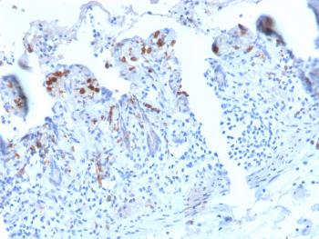 Anti-CD209 / DC-SIGN (Pathogen Receptor on Dendritic Cells) Monoclonal Antibody(Clone: C209/2749R)