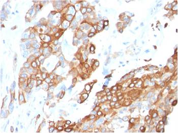 Anti-Heregulin-1 / Neuregulin-1 (Breast and Urothelial Marker) Monoclonal Antibody(Clone: NRG1/2710)