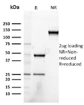 Anti-Heregulin-1 / Neuregulin-1 (Breast and Urothelial Marker) Monoclonal Antibody(Clone: NRG1/2752)