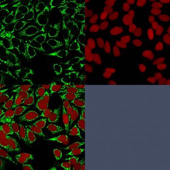 Anti-HIF1 alpha (Hypoxia-Inducible Factor 1-alpha) Monoclonal Antibody(Clone: HIF1A/84)