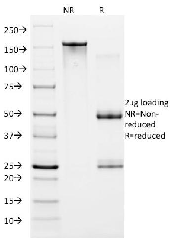 Anti-HIF1 alpha (Hypoxia-Inducible Factor 1-alpha) Monoclonal Antibody(Clone: ESEE122)