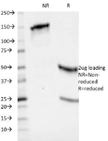 Anti-HLA-ABC (MHC I) Monoclonal Antibody(Clone: 246-B8.E7)